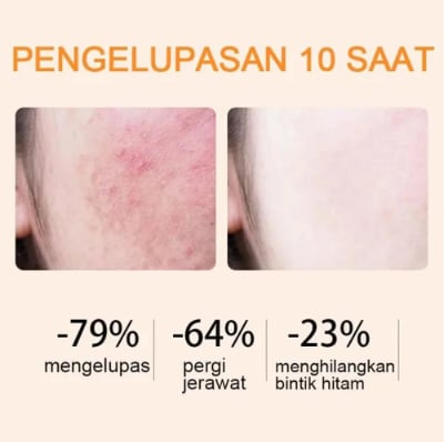 “BBOJI™ Orange Enzyme Exfoliating Gel — The Gentle Miracle Your Skin Has Been Crying Out For”