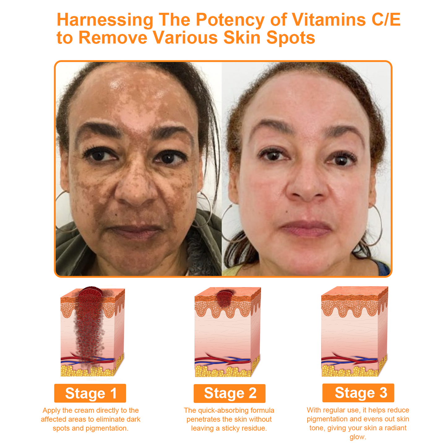 BBOJI™ 7-Day Multi-Effect All-in-One Skincare Cream (👨‍⚕️AAD Recommended)（🎇）