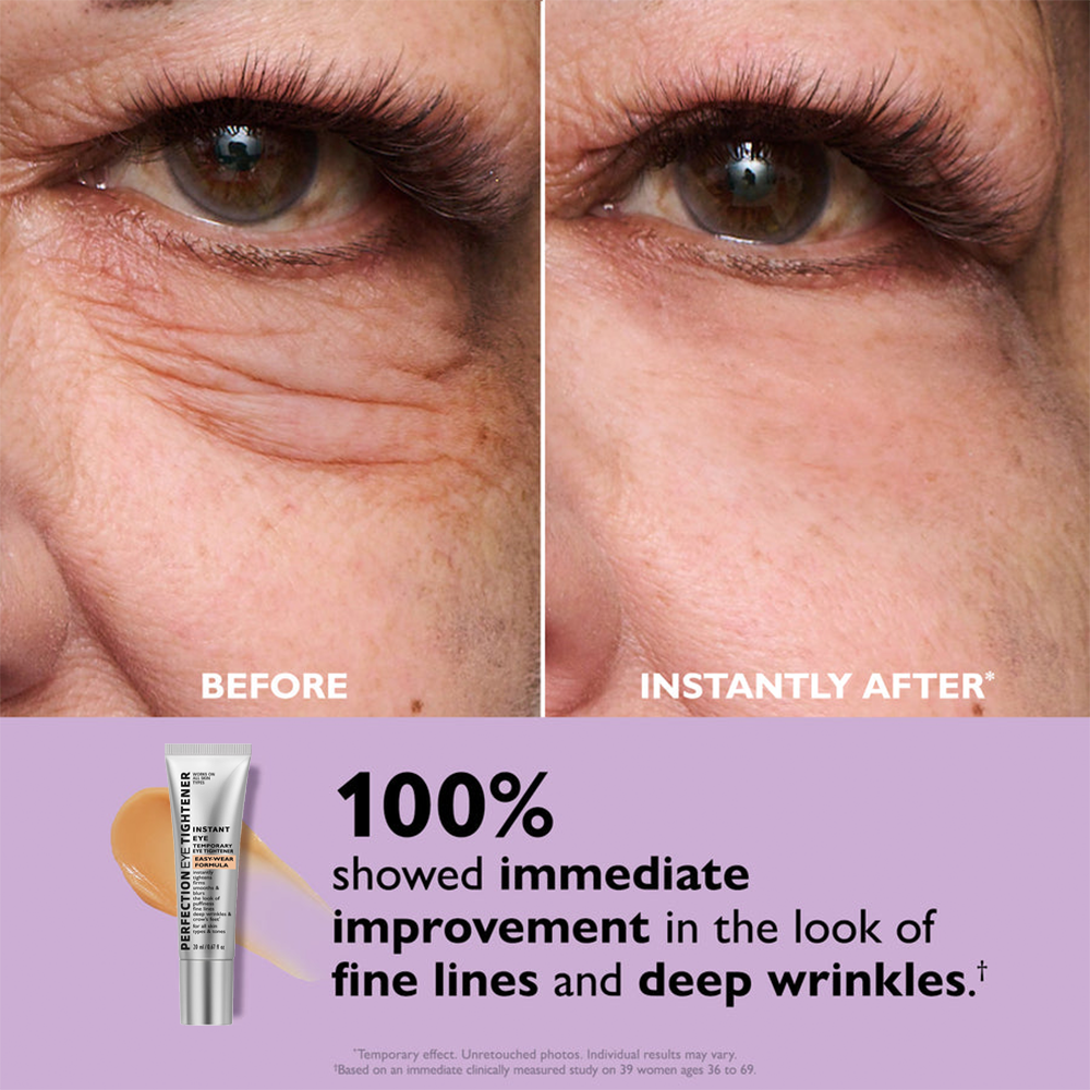 🌸Final Day: 87% OFF🌸 Instant Eye Tightener – Lift, Smooth & Look 10 Years Younger Instantly ✨
