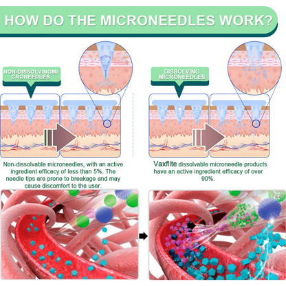 【Last Day Promotion 89% OFF🔥】Vaxflite™ NIDDK-Tirzepatide Slimming & health NANO MICRONEEDLE PATCH🇺🇸👨‍⚕️（Zero Pain, 24/7 Release | Lose 20lbs FAST | 90% Sugar Drop | ）