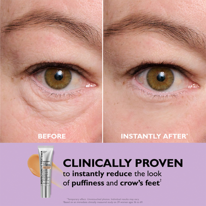 🌸Final Day: 87% OFF🌸 Instant Eye Tightener – Lift, Smooth & Look 10 Years Younger Instantly ✨