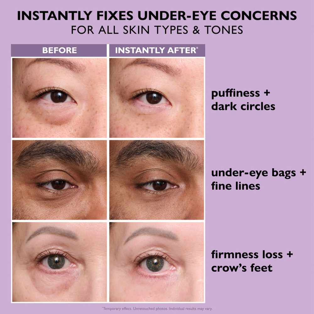 🌸Final Day: 87% OFF🌸 Instant Eye Tightener – Lift, Smooth & Look 10 Years Younger Instantly ✨