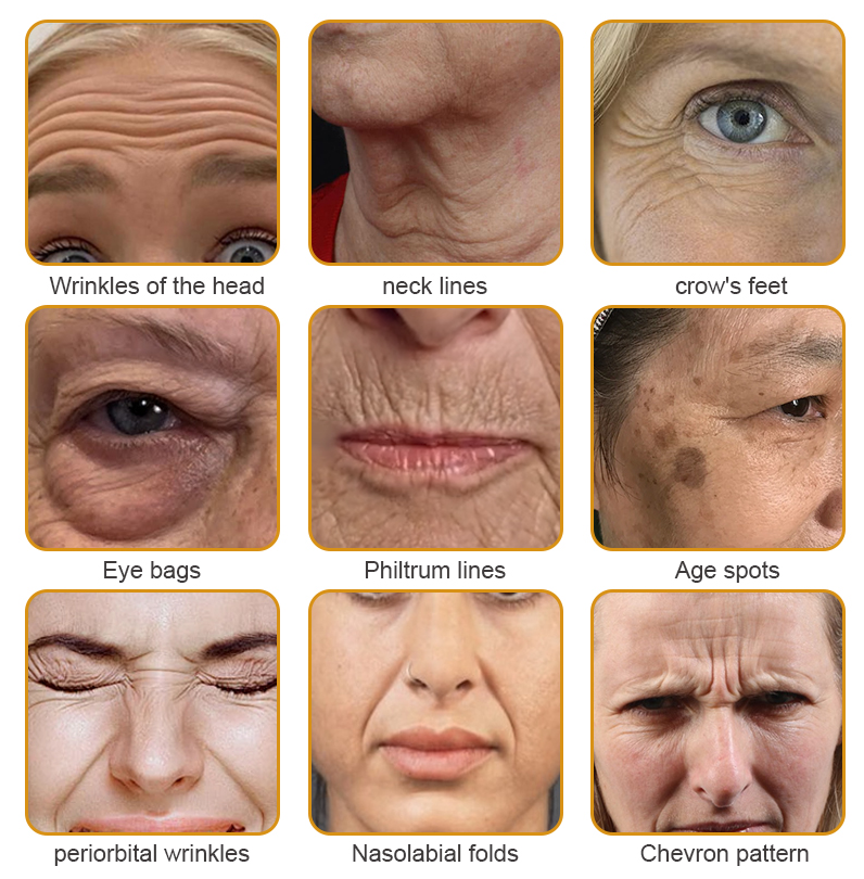 👨‍⚕️💐Made and Shipped from the USA✅ BBOJI™ Botulinum Bienengift Wrinkle Removal Cream-Last Day Promotion 70% OFF（🎇）