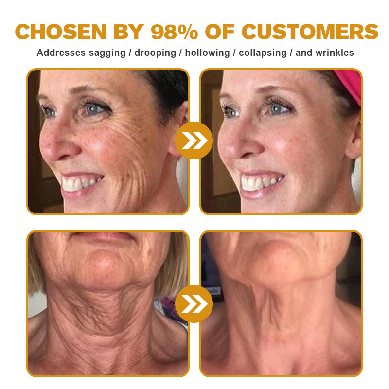 👨‍⚕️💐Made and Shipped from the USA✅ BBOJI™ Botulinum Bienengift Wrinkle Removal Cream-Last Day Promotion 70% OFF（🎇）