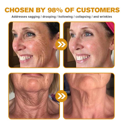 👨‍⚕️💐Made and Shipped from the USA✅ BBOJI™ Botulinum Bienengift Wrinkle Removal Cream-Last Day Promotion 70% OFF（🎇）