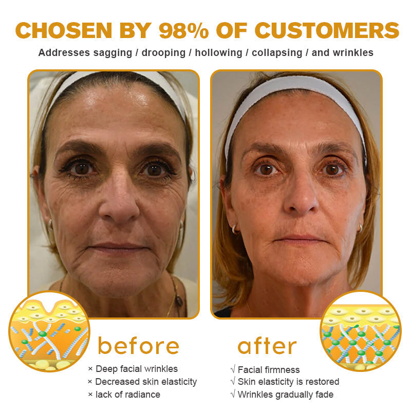 👨‍⚕️💐Made and Shipped from the USA✅ BBOJI™ Botulinum Bienengift Wrinkle Removal Cream-Last Day Promotion 70% OFF（🎇）