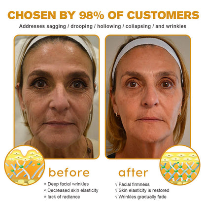 👨‍⚕️💐Made and Shipped from the USA✅ BBOJI™ Botulinum Bienengift Wrinkle Removal Cream-Last Day Promotion 70% OFF（🎇）